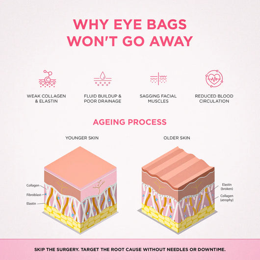 RevitalEyes® 2-in-1 Red Light Therapy + EMS To Erase Eye Bags